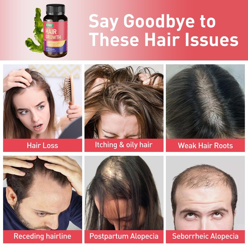 XKQ Hair Growth Supplements, Supports Hair Health & Fullness with