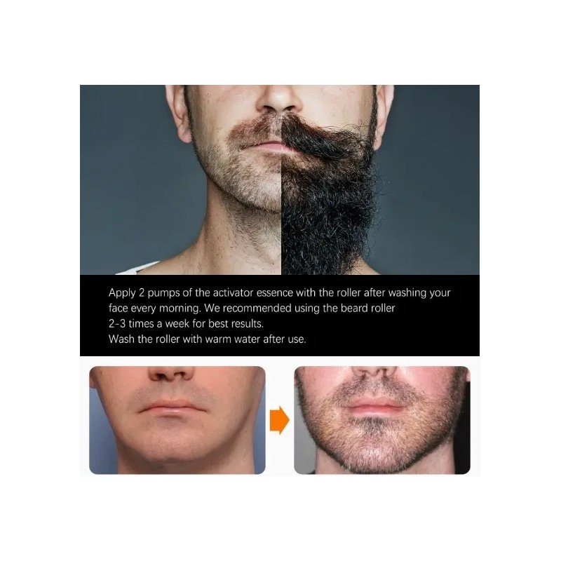 Dermaroller Barba Rodillo Facial Regenerador Aguja 0,5 Mm