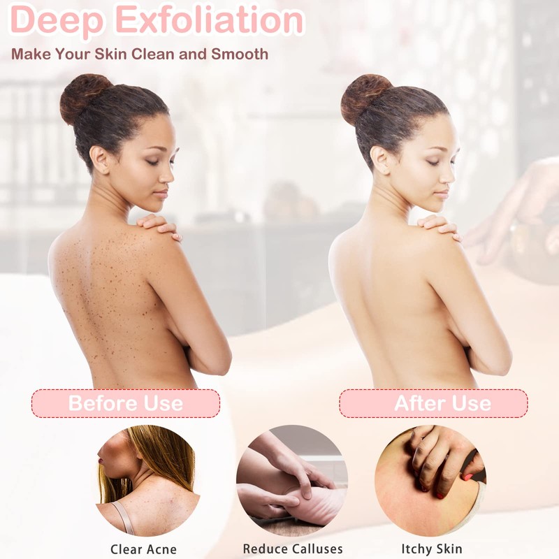 2 Pieces Exfoliating Back Scrubber for Shower, Double Sided Exfoliating