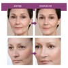 Barra Facial Hidratante Con Colágeno Para El Rostro