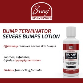 Bump Terminator Severe Bumps Lotion (4oz)