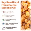 Frankincense Oil for Skin, 100% Pure and Natural Organic Frankincense