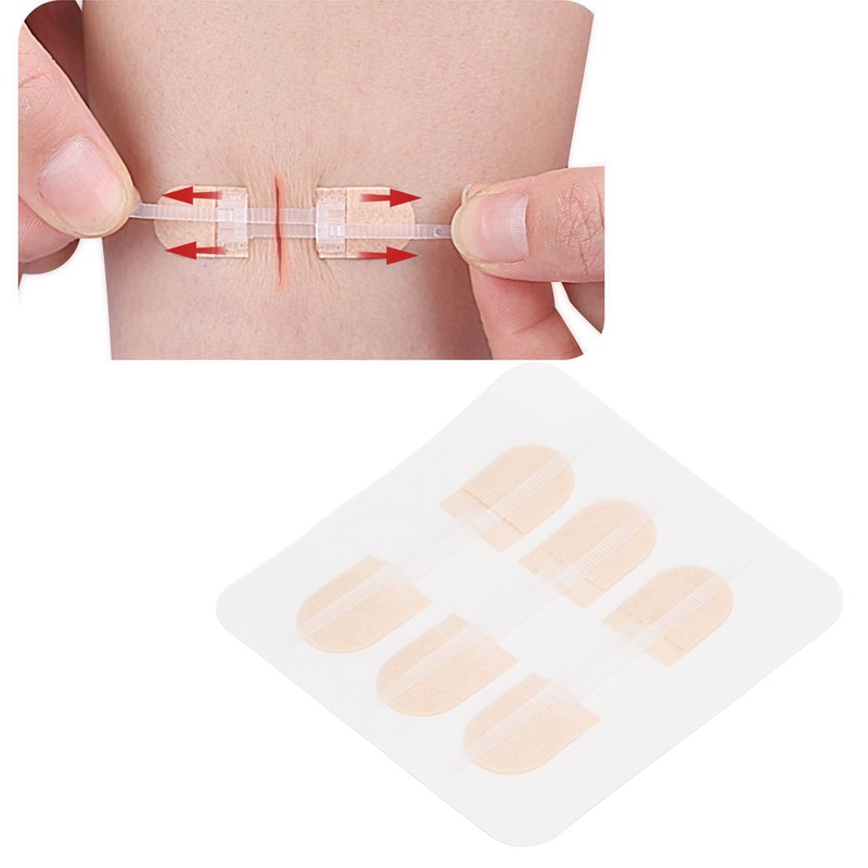 3 Strap Zipper Wound Closure Patches Breathable Seamless Elastic Zip