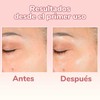 Super Serum 4 en 1 - Vitamina C + Ácido