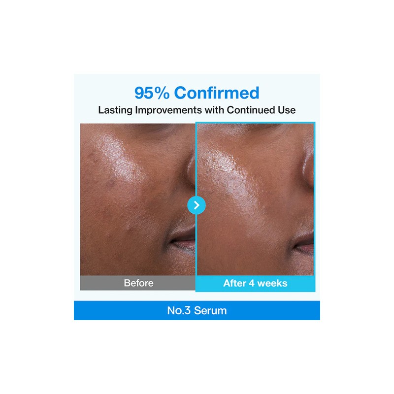 Numbuzin [Numbuzin]No.3 Blue Bio-Retinol Pore Refining Serum 30ml