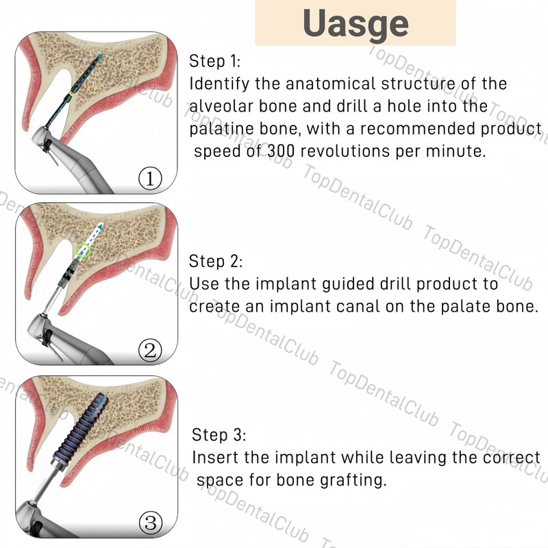 1Kit Dental JD Bone Track Drill Implant Guided Neck Correction