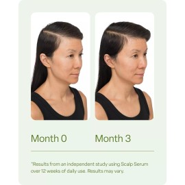 D Scalp Serum for Thinning Hair 30ml, Clinically Tested, Nourish For Thicker Hair