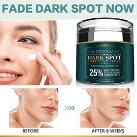 CITYGOO Eliminador de manchas oscuras para la cara: crema corrector de manchas oscuras - Cuidado enriquecedor de la piel para todos los tonos de piel 