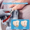 Landrain Nail Scissors Toenails, Nail Clippers for Strong Toenails, Nail