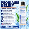 Dermasolve Champú Medicado Sin Caspa y Psoriasis Del Cuero Cabelludo