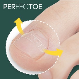 Perfecto Ingrown Toenail Corrector Self-Healing Correction Tips 10 Tape Set, 24mm / 퍼펙토 내성발톱 교정기 자가치료 교정팁 10매 테이프 세트, 24mm