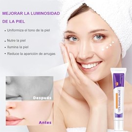 3PCS Crema cido Azelaico, Suero cido Azelaico, Suero Facial cido Azelaico 12, Suero Facial cido Azelaico cido Hialurnico, 20g3                        