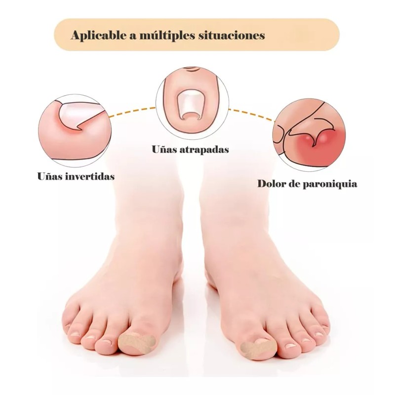 Dolores Kit Pedicure Corrector Uña Tratamient Enterradas Herramienta