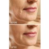 Dermactin-TS Crepe Be Gone Firming Neck Cream 3 oz.
