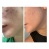 Crema Facial L2hcare Hidratante, Desmanchadora Y Antiarrugas