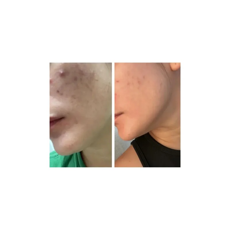 Crema Facial L2hcare Hidratante, Desmanchadora Y Antiarrugas