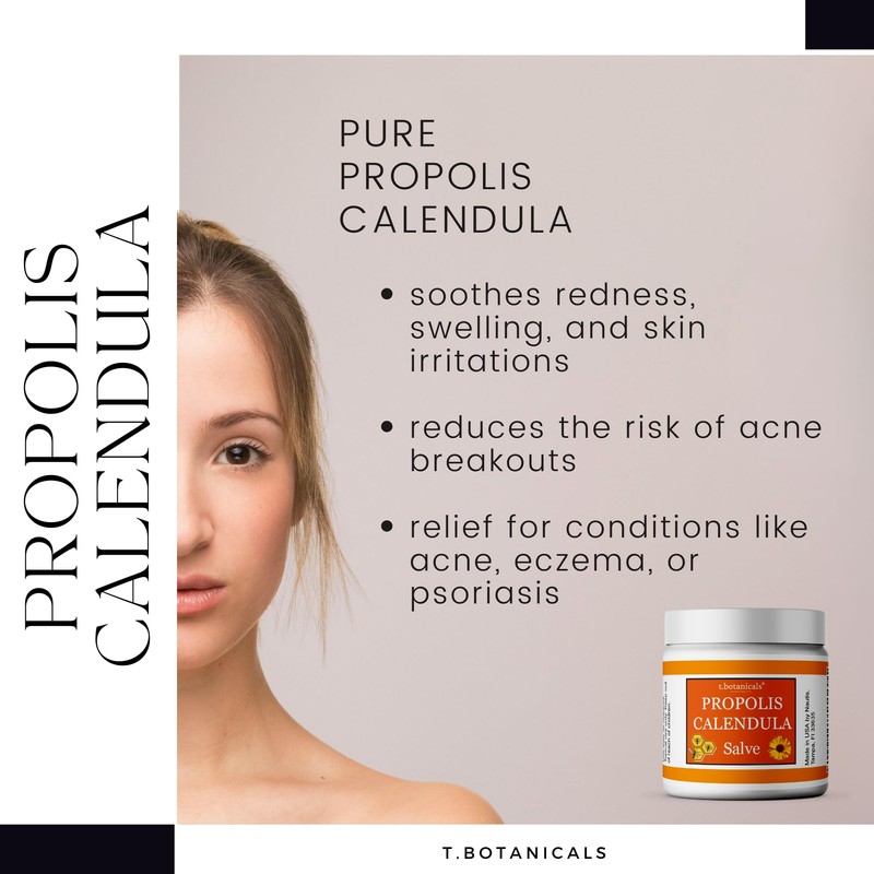 Propolis Calendula Salve, Skin Soothing Balm, Herbal Moisturizer, Made in