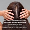Tratamiento Capilar con Romero, Kit Mensual, 10 Ampolletas de 4ml,