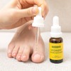 Perfecto Toenail Softener Nagelweischer 20ml / 퍼펙토 발톱연화제 나겔바이셔 20ml