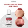 By the Quality Lactose Serum 50ml Acne Exclusive Serum Trouble
