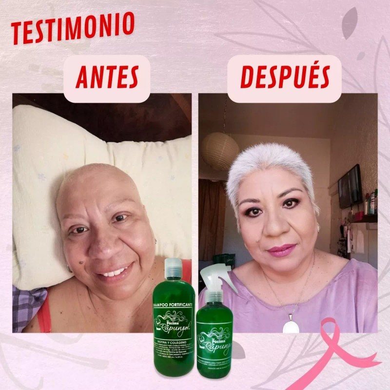 Pócima de Rapunzel Kit Shampoo Fortificante Anticaída 100% Efectivo