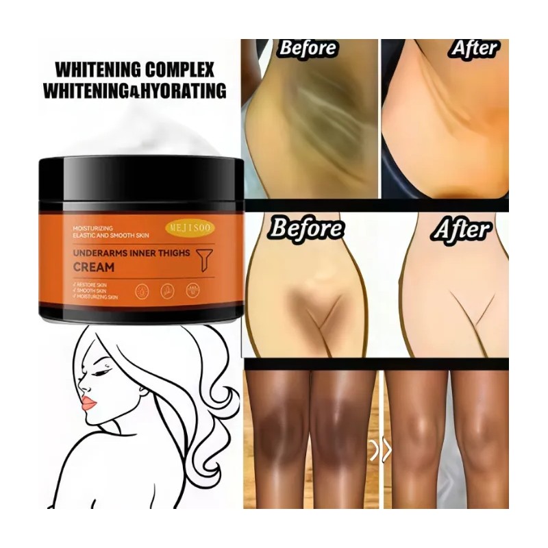 Adecuado Para Manchas, Cloasma Y Acné. Crema Antipecas.