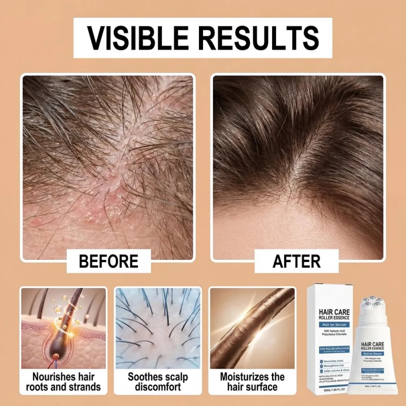 Hair Ampoule, Hair Roll-on With Castor Oil