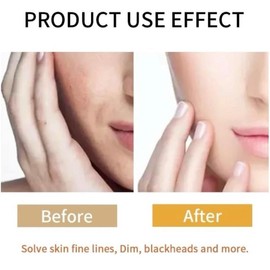 Set Coreano de arroz cuidado de la Cara Self-Care Juego de 5 productos para el cuidado de la piel de la cara de arroz,, White Skincare Skin Repair Mask Kit Facial Comfort