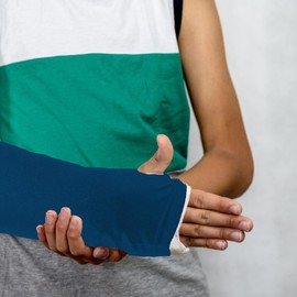 Artlan | Arm Cast Sleeve Cover | Protects Arm Cast and Aids in Keeping your Cast Clean. Arm Cast Cover Adult Cast Protectors for Wrist Casts and Dressings, Plaster Cast Protector. (Blue, M)