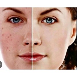 Serum Elimina Toxinas Arrugas Lineas Patas De Gallo Vc Normal Día/noche