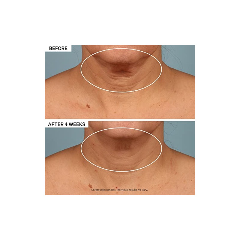 Strivectin Crema Cuello Ounces 19415 Gramo