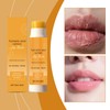 Lemon Turmeric Lip Balm - Lip Lightening for Dark Lips,