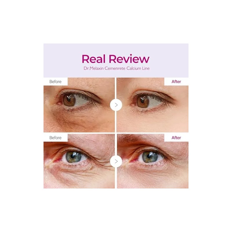 2 Paquetes De Parches Cemenrete Calcium Volume Eye 60