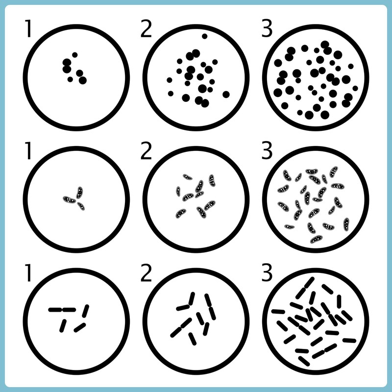 Fumete 60 Pcs Prepoured Agar Plates Kit Includes Petri Dishes