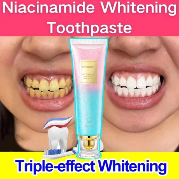 UTOGRU Niacinamide Whitening Toothpaste Nicotinamide Dazzling Whitening Toothpaste 100g
