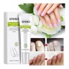 Compuesto completo para tratamiento de tiña Efero Nails, color blanco