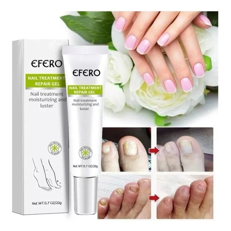 Compuesto completo para tratamiento de tiña Efero Nails, color blanco