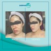 Jabón Dermabon Individual De 90 Gramos