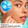 Spot Patches by Patch Perfect® (102 Pack) - Ultra-Thin Acne
