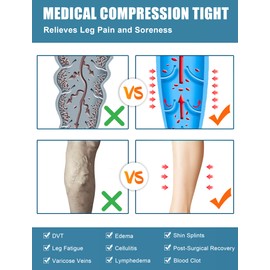 Evolyline 2 Pairs of Medical Compression Stockings for Men and Women, 20-30 mmHg, Class II Thigh Long Support Stockings, Compression Socks for Air Travel, Graduated Support for Varicose Veins