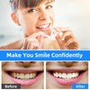 2 Pairs Instant Veneers Dentures, False Teeth Clip in Teeth