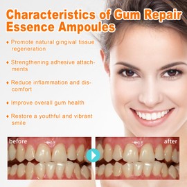 Gum Repair Essence Ampoules, Gum Regrowth Serum, Effective Whitening Ampoule Tooth Serum, Anti-Inflammatory Whitening Dental Disposable Serum, Enhances Gum, Reduces Inflammation & Gingival Recession