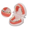 Teeth Dental Demonstration Model, Dental Typodont Tooth Model with Orthodontic