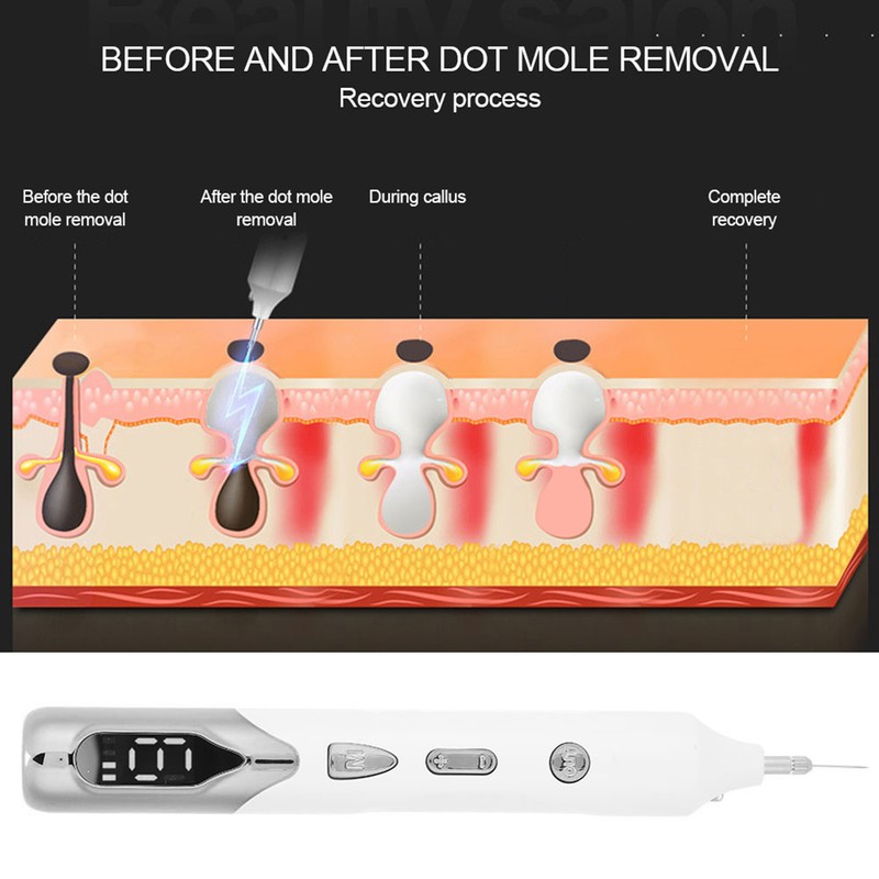 Electric Freckle Removal Pen 9 Gears Adjustment Painless Spots Pigment