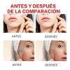144 Parche Adhesivos Para Imperfecciones Piel Acné Verrugas