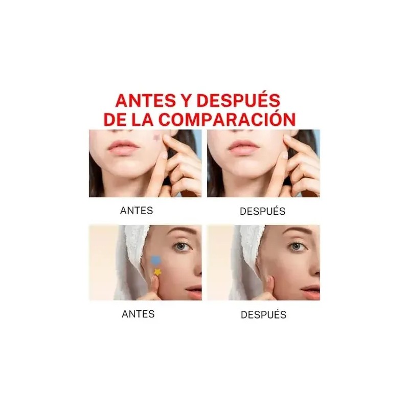 144 Parche Adhesivos Para Imperfecciones Piel Acné Verrugas
