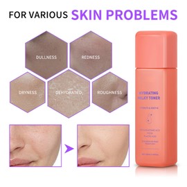Hydrating Milky Toner for Dry Skin, Ultra Hydrating Toner for Face, Hydratin-g Serum Face Moisturizer - Soothes Skin, Locks in Moisture, Reduces Redness - Barrier Repair, Vegan, Preppy Skincare