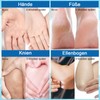 Virellay Urea Cream 60 Percent Foot Cream for Dry, Cracked