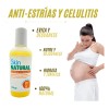 Kit 2 Piezas Anti Estrías Y Celulitis 125ml Skin Natural