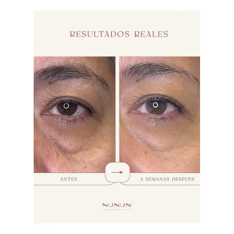 Suero De Ojos Para Bolsas Ojeras Instant Lift Eye Nunun